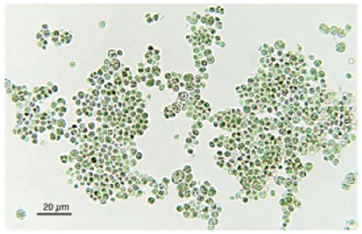 Observation microscopique des cellules sphériques de Chlorella