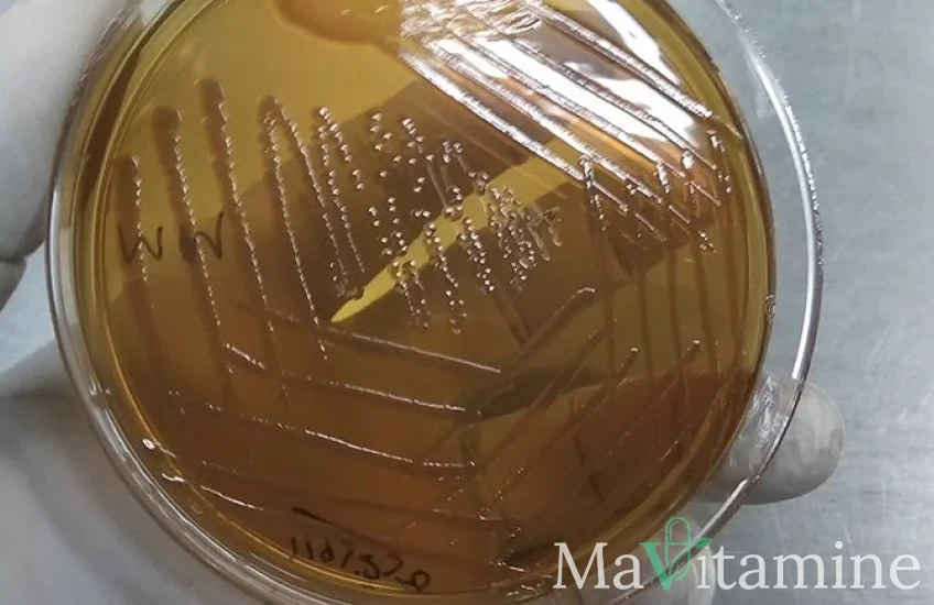 Bactérie Morganella morganii cultivée en laboratoire, impliquée dans l'inflammation liée à la dépression